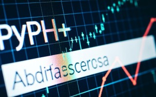 php服务器ip获取方法有哪些？如何准确获取服务器真实ip地址？